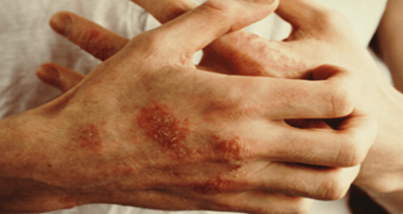 1661190531198.png 1661190531198.png